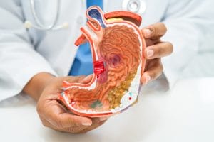 Doctor holding a model of a stomach in his hands